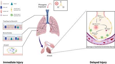 Phosgene-Induced acute lung injury: Approaches for mechanism-based treatment strategies